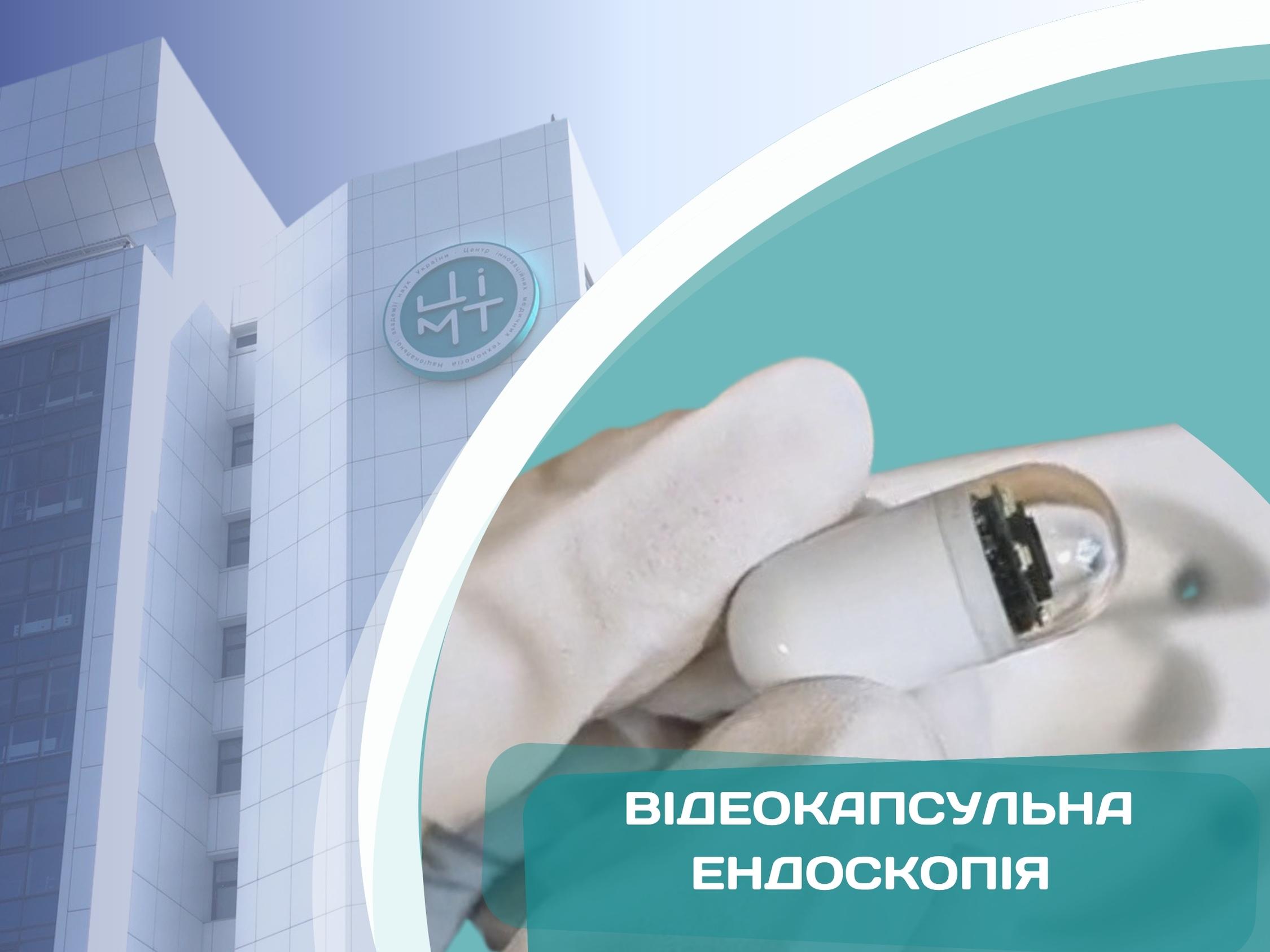 Відеокапсульна ендоскопія