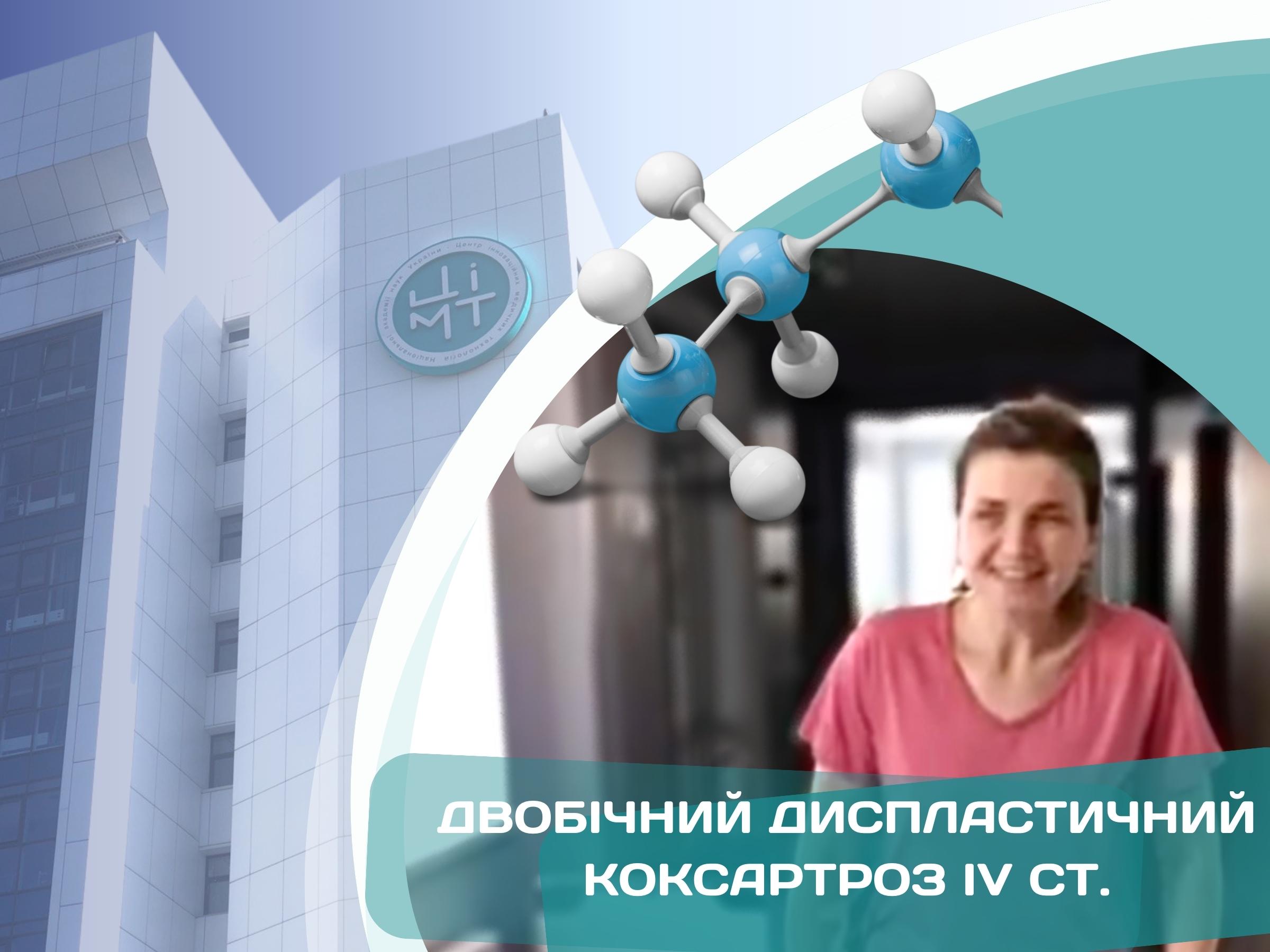 Клінічний випадок. Двобічний диспластичний коксартроз IV ст.