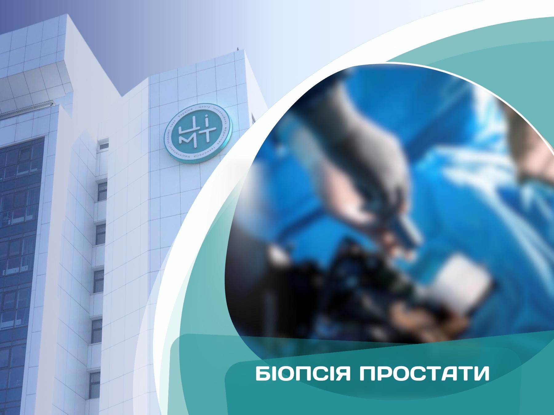 Біопсія простати