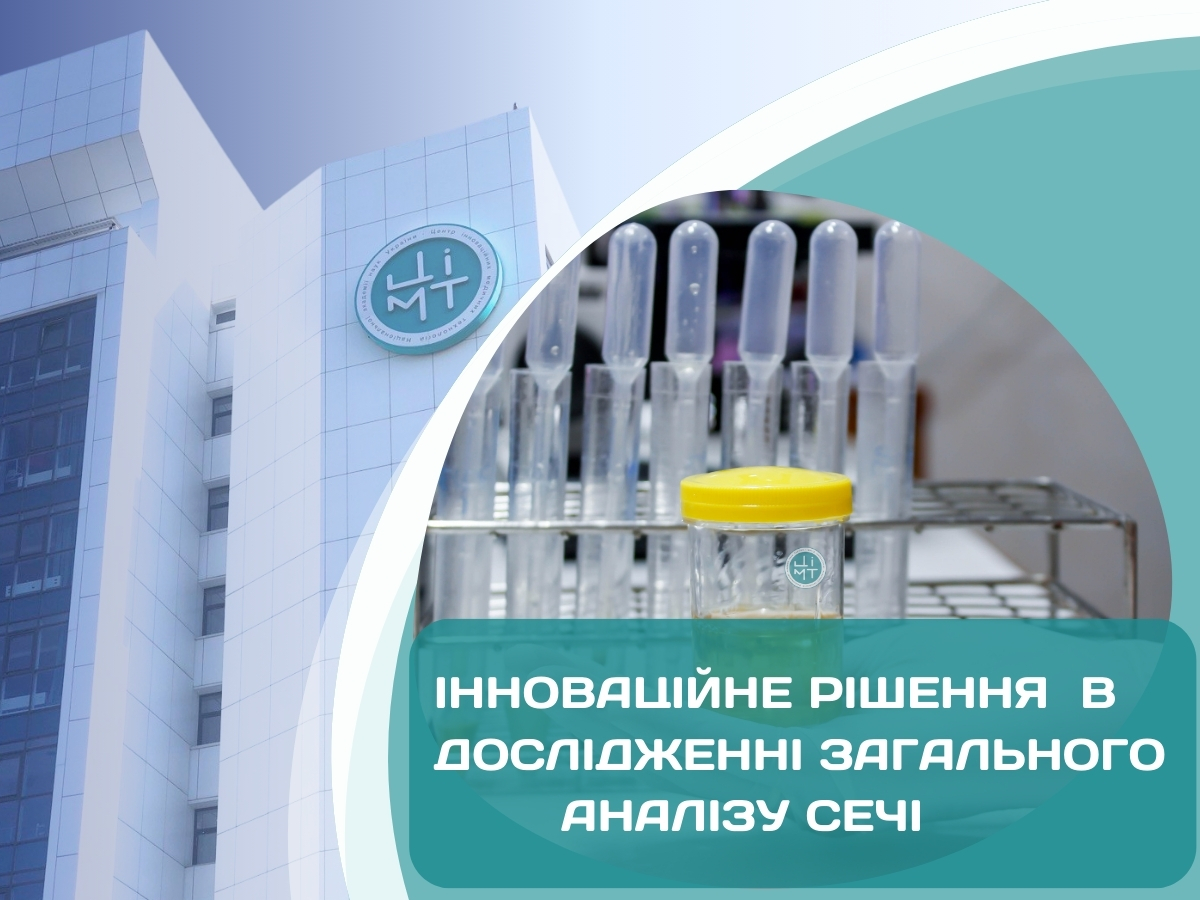 Інноваційне рішення в дослідженні загального аналізу сечі