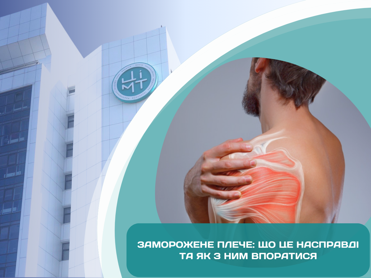Заморожене плече: міфи та факти, які допоможуть швидше повернути рухливість